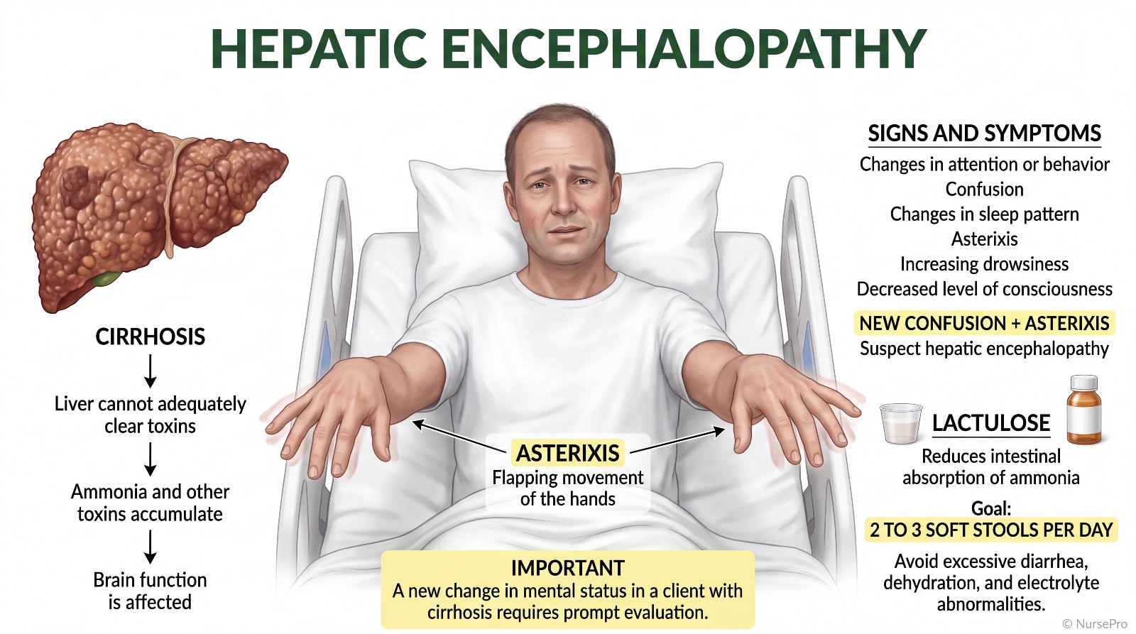 Hepatic encephalopathy: a scarred cirrhotic liver failing to clear ammonia, the resulting confusion and asterixis, and lactulose as the treatment that removes ammonia through the stool.